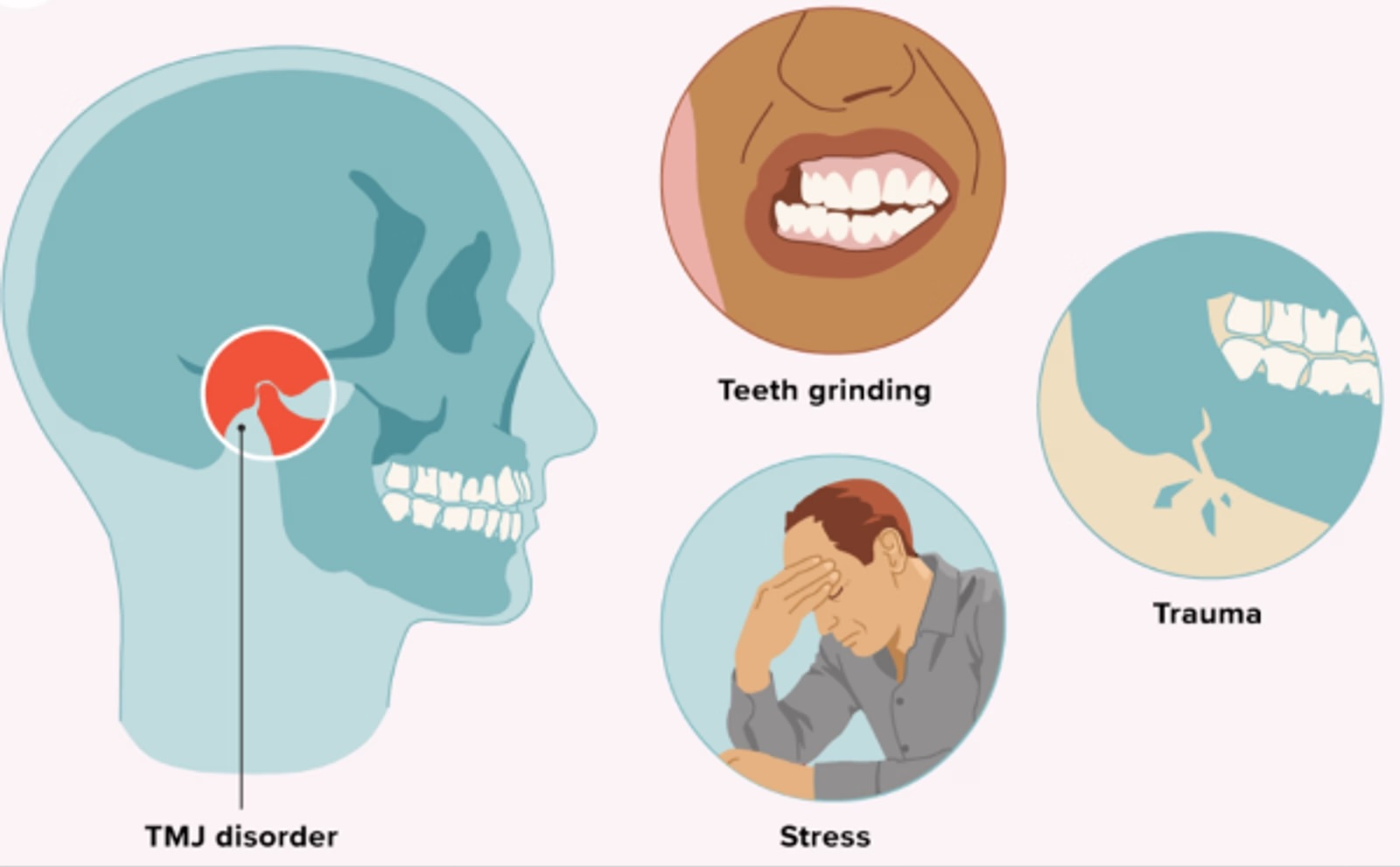 Mechanical causes of acute jaw pain.