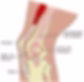 Iliotibial band syndrome, osteopath Beirut