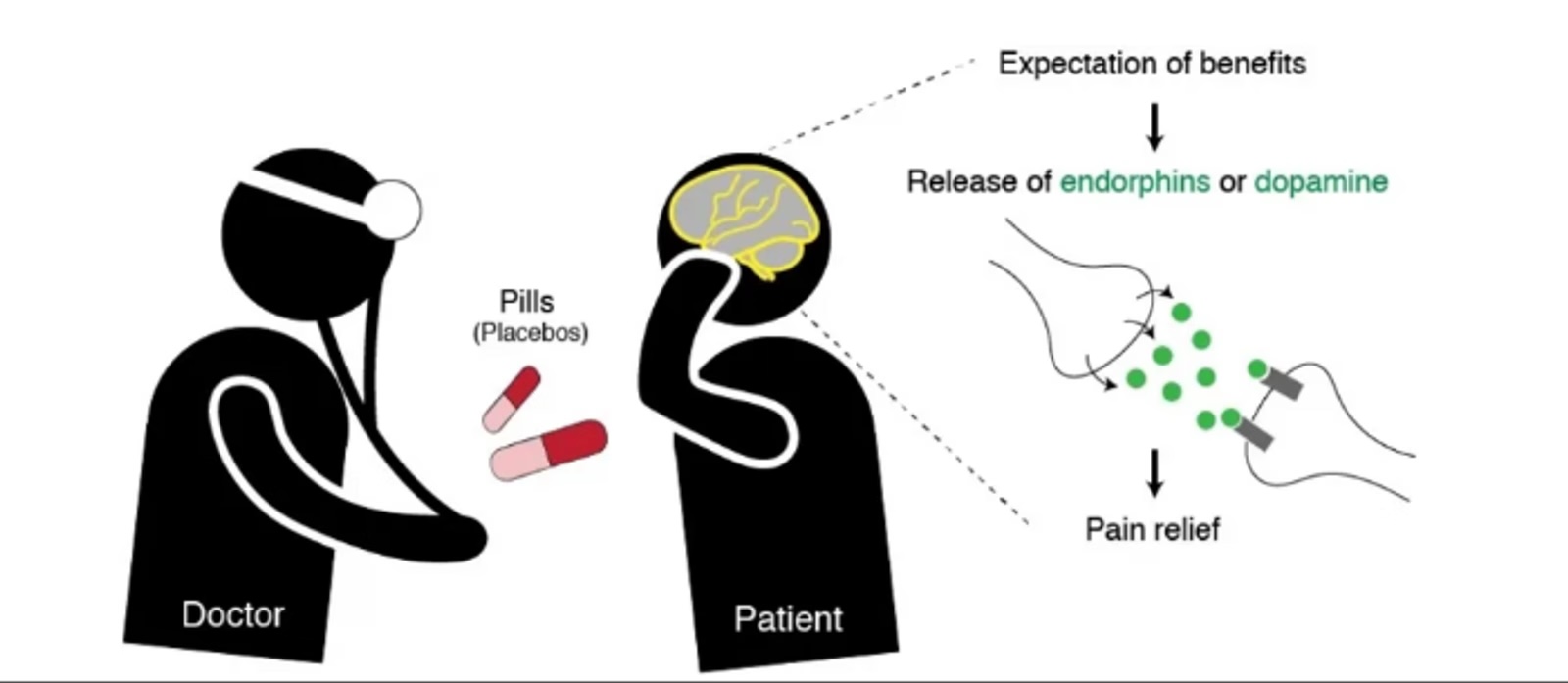 Placebo effect and pain