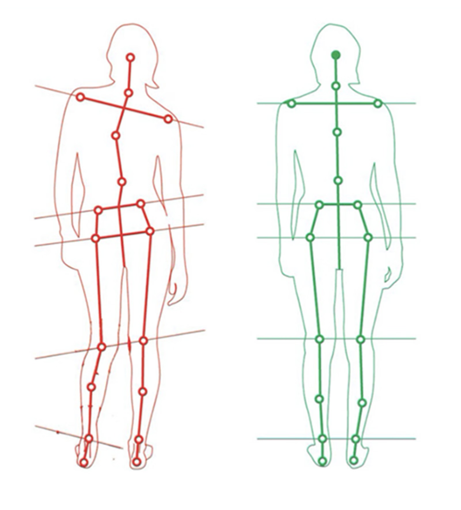 Postural analysis, osteopath Beirut