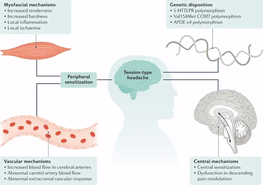 Causes and mechanisms of tension headache (Nat Rev Dis Primers. 2021;7:24)