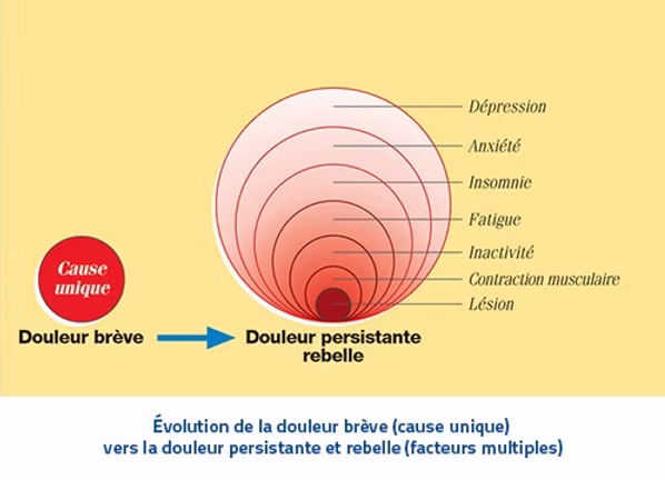 Progression from acute to chronic pain